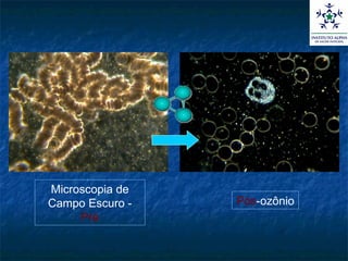 Microscopia de Campo Escuro -  Pré Pós -ozônio 