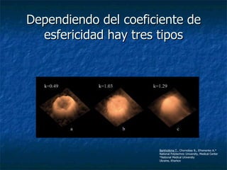 Dependiendo del coeficiente de esfericidad hay tres tipos Barkhotkina T ., Chornobay B., Efremenko A.* National Polytechnic University, Medical Center *National Medical University Ukraine, Kharkov 