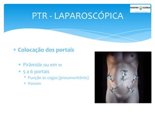PTR - LAPAROSCÓPICA

Colocação dos portais
Pirâmide ou em w
5 a 6 portais
* Punção às cegas (pneumoritônio)
Hasson

 
