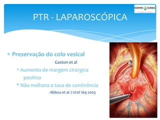 PTR - LAPAROSCÓPICA

Preservação do colo vesical
Gaston et al

* Aumento de margem cirúrgica

positiva
* Não melhora a taxa de continência
Abbou et al J Urol 169 2003

 