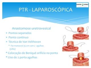 PTR - LAPAROSCÓPICA

Anastomose uretrovesical
Pontos separados
Ponto contínuo
Técnica de Van Velthoven
* Fio monocryl 35 cm com 2 agulhas
(UR6)

* Colocação de Beniqué orifício na ponta
* Uso de 2 porta agulhas

 