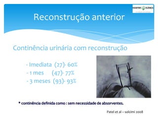 Reconstrução anterior
Continência urinária com reconstrução
- Imediata (27)- 60%
- 1 mes (47)- 77%
- 3 meses (93)- 93%

* continência definida como : sem necessidade de absorventes.
Patel et al – solcimi 2008

 