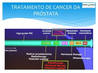 TRATAMENTO DE CANCER DA
PRÓSTATA

 