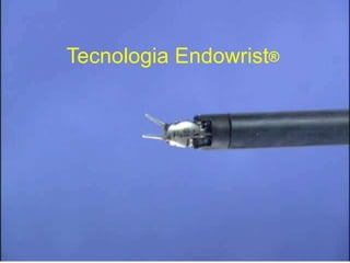 Tecnologia Endowrist®

 