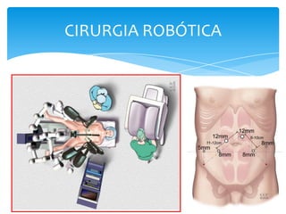 CIRURGIA ROBÓTICA

 