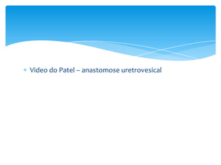 Video do Patel – anastomose uretrovesical

 