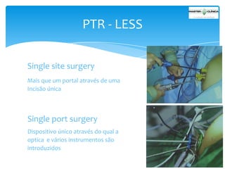 PTR - LESS
Single site surgery
Mais que um portal através de uma
Incisão única

Single port surgery
Dispositivo único através do qual a
optica e vários instrumentos são
introduzidos

 