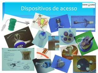 Dispositivos de acesso

 