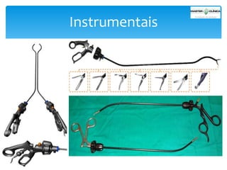Instrumentais

 
