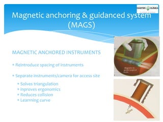 Magnetic anchoring & guidanced system
(MAGS)

MAGNETIC ANCHORED INSTRUMENTS
Reintroduce spacing of instruments
Separate instruments/camera for access site

Solves triangulation
inproves ergonomics
Reduces collision
Learrning curve

 
