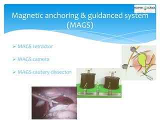 Magnetic anchoring & guidanced system
(MAGS)
 MAGS retractor
 MAGS camera

 MAGS cautery dissector

 