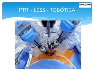 PTR - LESS - ROBÓTICA

 