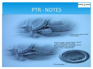 PTR - NOTES

 