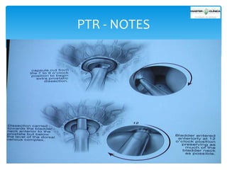 PTR - NOTES

 