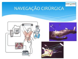 NAVEGAÇÃO CIRÚRGICA

 