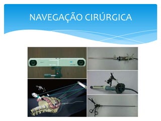 NAVEGAÇÃO CIRÚRGICA

 