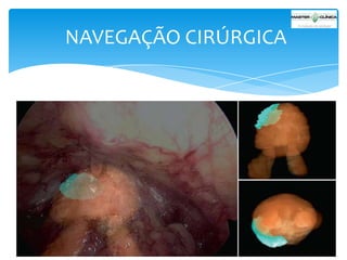NAVEGAÇÃO CIRÚRGICA

 