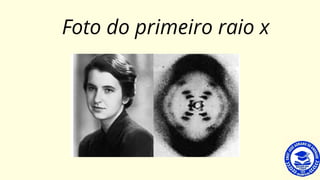 Foto do primeiro raio x
 