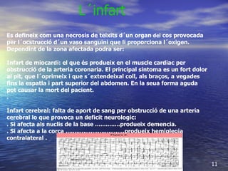 L´infart   Es defineix com una necrosis de teixits d´un organ  del  cos provocada per l´ocstrucció d´un vaso sanguini que li proporciona l´oxigen. Dependint de la zona afectada podra ser:  Infart de miocardi: el que és produeix en el muscle cardiac per obstrucció de la arteria coronaria. El principal sintoma es un fort dolor al pit, que l´oprimeix i que s´extendeixal coll, als braços, a vegades fins la espatla i part superior del abdomen. En la seua forma aguda pot causar la mort del pacient. .  Infart cerebral: falta de aport de sang per obstrucció de una arteria cerebral lo que provoca un deficit neurologic:  . Si afecta als nuclis de la base ..............produeix demencia. . Si afecta a la corça .................................produeix hemiplegia  contralateral .          11 