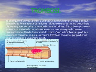 TROMBOSI.   Es el bloqueo d´un vas sanguini o una cavitat cardiaca per un trombo o coagul. El trombo es forma a partir de la fibrina i altres elements de la sang denominats plaquetes que es depositen a la superfici interna del vas. El trombo es pot formar en una arteria afectada per arteriosclerosis o a una vena quan la persona permaneix inmovilitzada durant molt de temps. Quan la trombosis es produix a una arteria coronaria, lo que es denomina trombosis coronaria, pot produir un infart de miocardi o una angina de pit. 12 