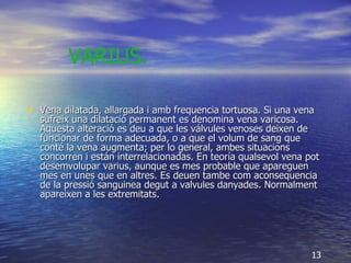 Vena dilatada, allargada i amb frequencia tortuosa. Si una vena sufreix una dilatació permanent es denomina vena varicosa. Aquesta alteració es deu a que les válvules venoses deixen de funcionar de forma adecuada, o a que el volum de sang que conté la vena augmenta; per lo general, ambes situacions concorren i están interrelacionadas. En teoría qualsevol vena pot desemvolupar varius, aunque es mes probable que apareguen mes en unes que en altres. Es deuen tambe com aconsequencia de la pressió sanguinea degut a valvules danyades. Normalment apareixen a les extremitats. VARIUS.   13 