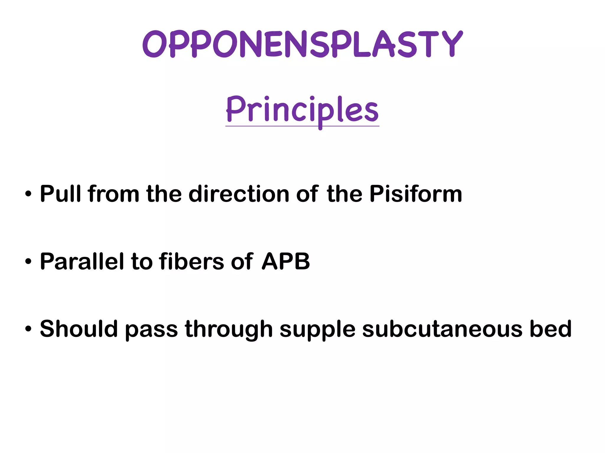 OPPONENSPLASTY
Principles
• Pull from the direction of the Pisiform
• Parallel to fibers of APB
• Should pass through supple subcutaneous bed
 