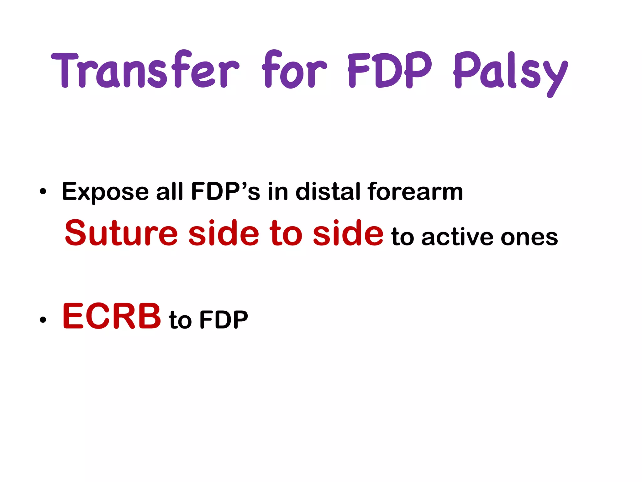 Transfer for FDP Palsy
• Expose all FDP’s in distal forearm
Suture side to side to active ones
• ECRB to FDP
 