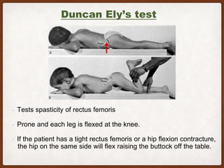 Elys Test