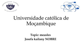 Universidade católica de
Moçambique
Topic: measles
Josefa kailany NOBRE
 