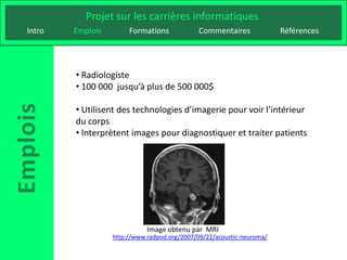 Projet sur les carrières informatiques
Intro   Emplois        Formations            Commentaires              Références




        • Radiologiste
        • 100 000 jusqu’à plus de 500 000$

        • Utilisent des technologies d’imagerie pour voir l’intérieur
        du corps
        • Interprètent images pour diagnostiquer et traiter patients




                             Image obtenu par MRI
                  http://www.radpod.org/2007/09/22/acoustic-neuroma/
 