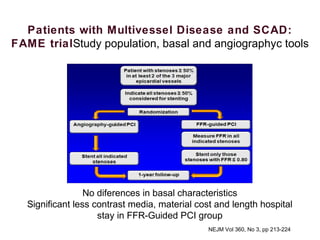NEJM Vol 360, No 3, pp 213-224.
No diferences in basal characteristics
Significant less contrast media, material cost and length hospital
stay in FFR-Guided PCI group
Patients with Multivessel Disease and SCAD:
FAME trialStudy population, basal and angiographyc tools
 
