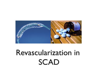 Revascularization in
SCAD
 