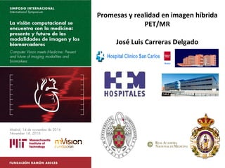 Promesas y realidad en imagen híbrida
PET/MR
José Luis Carreras Delgado
 