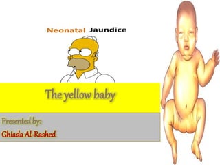 Name: Ghaida alrashed
The yellow baby
Presented by:
Ghiada Al-Rashed
 
