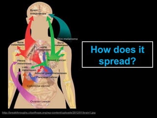 http://breakthroughs.cityofhope.org/wp-content/uploads/2012/01/brain1.jpg
How does it
spread?
 