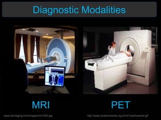 Diagnostic Modalities
www.dximaging.com/images/mri.ht53.jpg http://www.cerebromente.org.br/n01/pet/scanner.gif
MRI PET
 