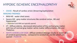 HYPOXIC ISCHEMIC ENCEPHALOPATHY
• CAUSE : Result of cardiac arrest /drowning/asphyxiation
IMAGING FINDINGS:
• Mild HIE : water shed zones
• Severe HIE : grey matter structures like cerebral cortex , BG and
hippocampi.
• Brainstem and WM are typically spared.
• CT : Diffuse edema , decreased attenuation of the cortical gray matter
with loss of normal gray matter–white matter differentiation, BG and
Thalamus
• WHITE CEREBELLUM SIGN : diffuse cerebral damage results in lower attn.
of cerebral parenchyma , compared to cerebellum and BG which are
spared – POOR PX
 