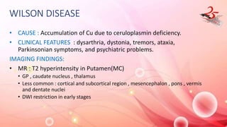 WILSON DISEASE
• CAUSE : Accumulation of Cu due to ceruloplasmin deficiency.
• CLINICAL FEATURES : dysarthria, dystonia, tremors, ataxia,
Parkinsonian symptoms, and psychiatric problems.
IMAGING FINDINGS:
• MR : T2 hyperintensity in Putamen(MC)
• GP , caudate nucleus , thalamus
• Less common : cortical and subcortical region , mesencephalon , pons , vermis
and dentate nuclei
• DWI restriction in early stages
 