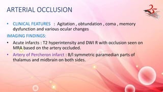 ARTERIAL OCCLUSION
• CLINICAL FEATURES : Agitation , obtundation , coma , memory
dysfunction and various ocular changes
IMAGING FINDINGS:
• Acute infarcts : T2 hyperintensity and DWI R with occlusion seen on
MRA based on the artery occluded.
• Artery of Percheron infarct : B/l symmetric paramedian parts of
thalamus and midbrain on both sides.
 