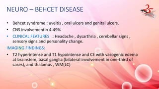 NEURO – BEHCET DISEASE
• Behcet syndrome : uveitis , oral ulcers and genital ulcers.
• CNS involvementin 4-49%
• CLINICAL FEATURES : Headache , dysarthria , cerebellar signs ,
sensory signs and personality change.
IMAGING FINDINGS:
• T2 hyperintense and T1 hypointense and CE with vasogenic edema
at brainstem, basal ganglia (bilateral involvement in one-third of
cases), and thalamus , WM(LC)
 