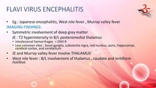 FLAVI VIRUS ENCEPHALITIS
• Eg : Japanese encephalitis, West nile fever , Murray valley fever
IMAGING FINDINGS:
• Symmetric involvement of deep grey matter
JE : T2 hyperintensity in B/L posteromedial thalamus
• Intralesional hemorrhages + DWI R
• Less common sites : basal ganglia, substantia nigra, red nucleus, pons, hippocampi,
cerebral cortex, and cerebellum.
• JE and Murray valley fever involve THALAMUS
• West nile fever : B/L involvement of thalamus , caudate and lentiform
nucleus
 