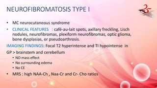 NEUROFIBROMATOSIS TYPE I
• MC neurocutaneous syndrome
• CLINICAL FEATURES : café-au-lait spots, axillary freckling, Lisch
nodules, neurofibromas, plexiform neurofibromas, optic glioma,
bone dysplasias, or pseudoarthrosis.
IMAGING FINDINGS: Focal T2 hyperintense and TI hypointense in
GP > brainstem and cerebellum
• NO mass effect
• No surrounding edema
• No CE
• MRS : high NAA-Ch , Naa-Cr and Cr- Cho ratios
 
