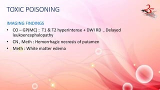 TOXIC POISONING
IMAGING FINDINGS
• CO – GP(MC) : T1 & T2 hyperintense + DWI RD , Delayed
leukoencephalopathy
• CN , Meth : Hemorrhagic necrosis of putamen
• Meth : White matter edema
 