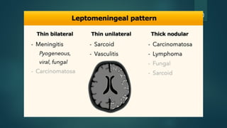 Cns Pattern Enhancement patterns in different cns diseases | PPTX