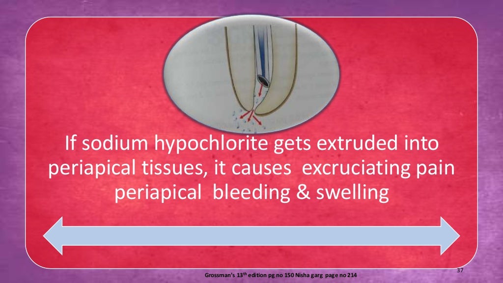 Sodium hypochlorite and its use as an endodontic irrigant Australian
