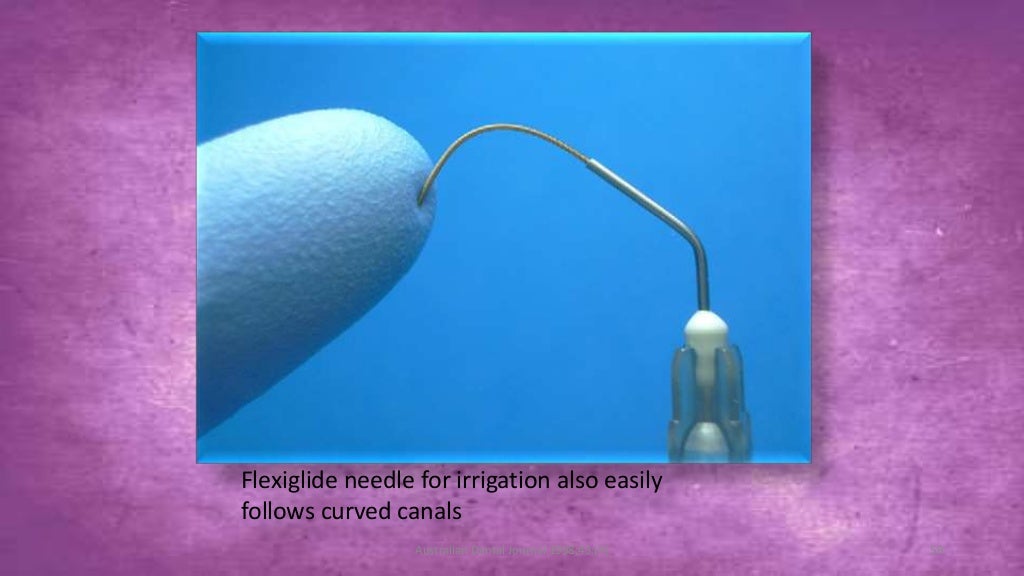 Sodium hypochlorite and its use as an endodontic irrigant Australian