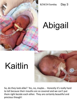 Kaitlin 
8/24/14 Sunday Day 3 
Abigail 
So, do they look alike? Yes, no, maybe… Honestly it’s really hard 
to tell because their mouths are so covered and we can’t put 
them right beside each other. They are certainly beautiful and 
precious though! 
 