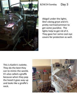 Abigail under the lights. 
She’s doing great and it’s 
pretty normal/common to 
get some jaundice. The 
lights help to get rid of it. 
They gave her some cool eye 
covers for protection as well. 
This is Kaitlin’s isolette. 
They do the best they 
can to mimic the womb. 
It’s also called a giraffe 
because when they pop 
the hood it goes way up 
and looks like a giraffe’s 
neck. 
8/24/14 Sunday Day 3 
 