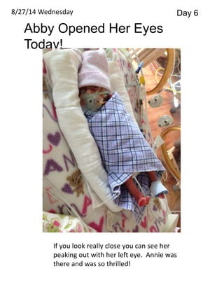 8/27/14 Wednesday Day 6 
Abby Opened Her Eyes 
Today! 
If you look really close you can see her 
peaking out with her left eye. Annie was 
there and was so thrilled! 
 