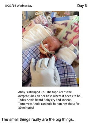 8/27/14 Wednesday Day 6 
Abby is all taped up. The tape keeps the 
oxygen tubes on her nose where it needs to be. 
Today Annie heard Abby cry and sneeze. 
Tomorrow Annie can hold her on her chest for 
30 minutes! 
The small things really are the big things. 
 
